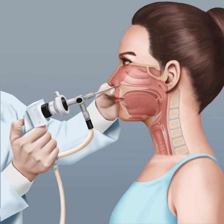 nasal endoscopy