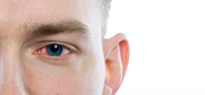 watery eyes from chemo drug Taxotere