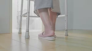 PERIPHERAL EDEMA FROM TAXOTERE 2